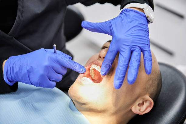 Best Emergency Wisdom Tooth Extraction in Staples, MN